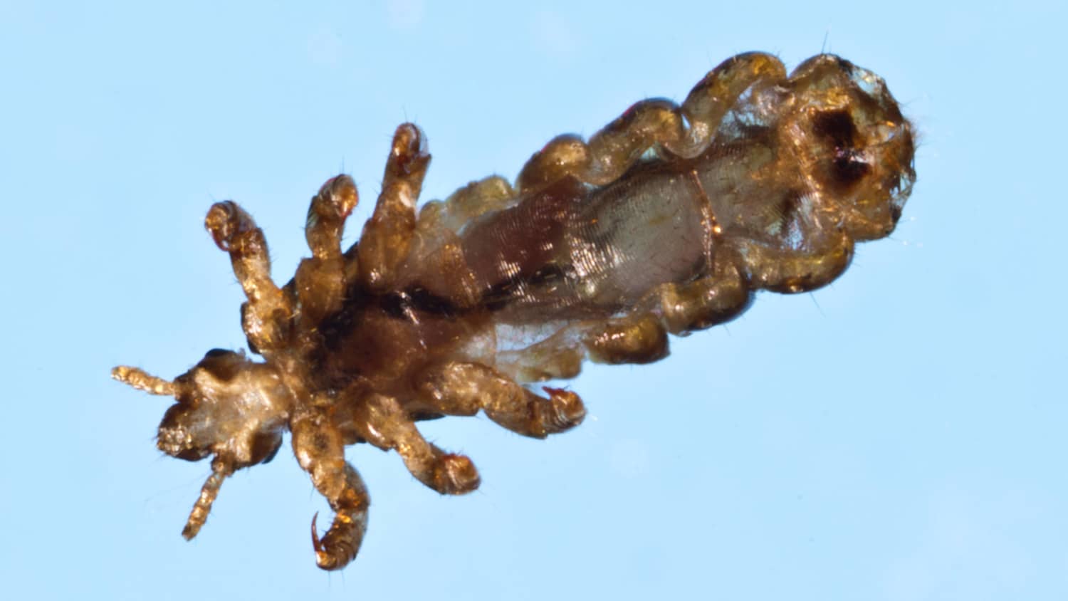 Mikroskopaufnahme einer Kleiderlaus, Pediculus humanus