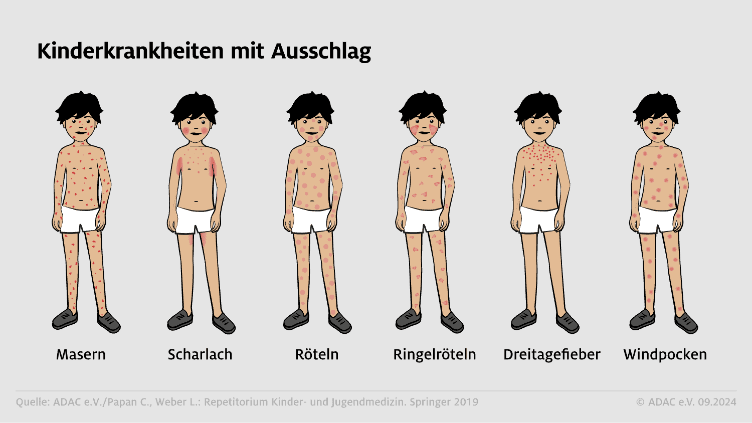 Kinderkrankheiten mit Ausschlag