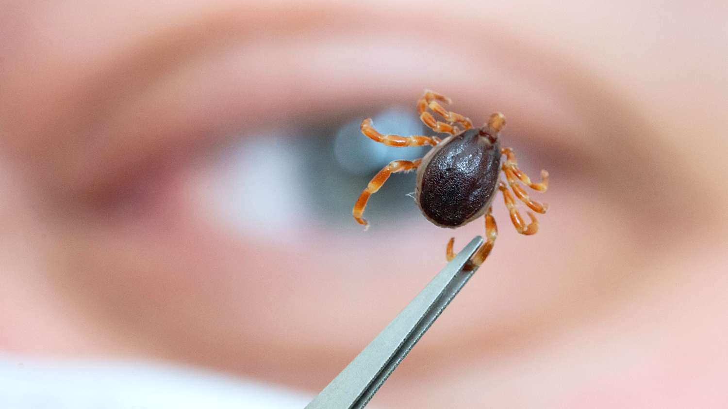 Ein Mitarbeiter des Instituts für Zoologie, Fachgebiet Parasitologie, der Universität Hohenheim, zeigt eine tote Haarige Hyalomma.