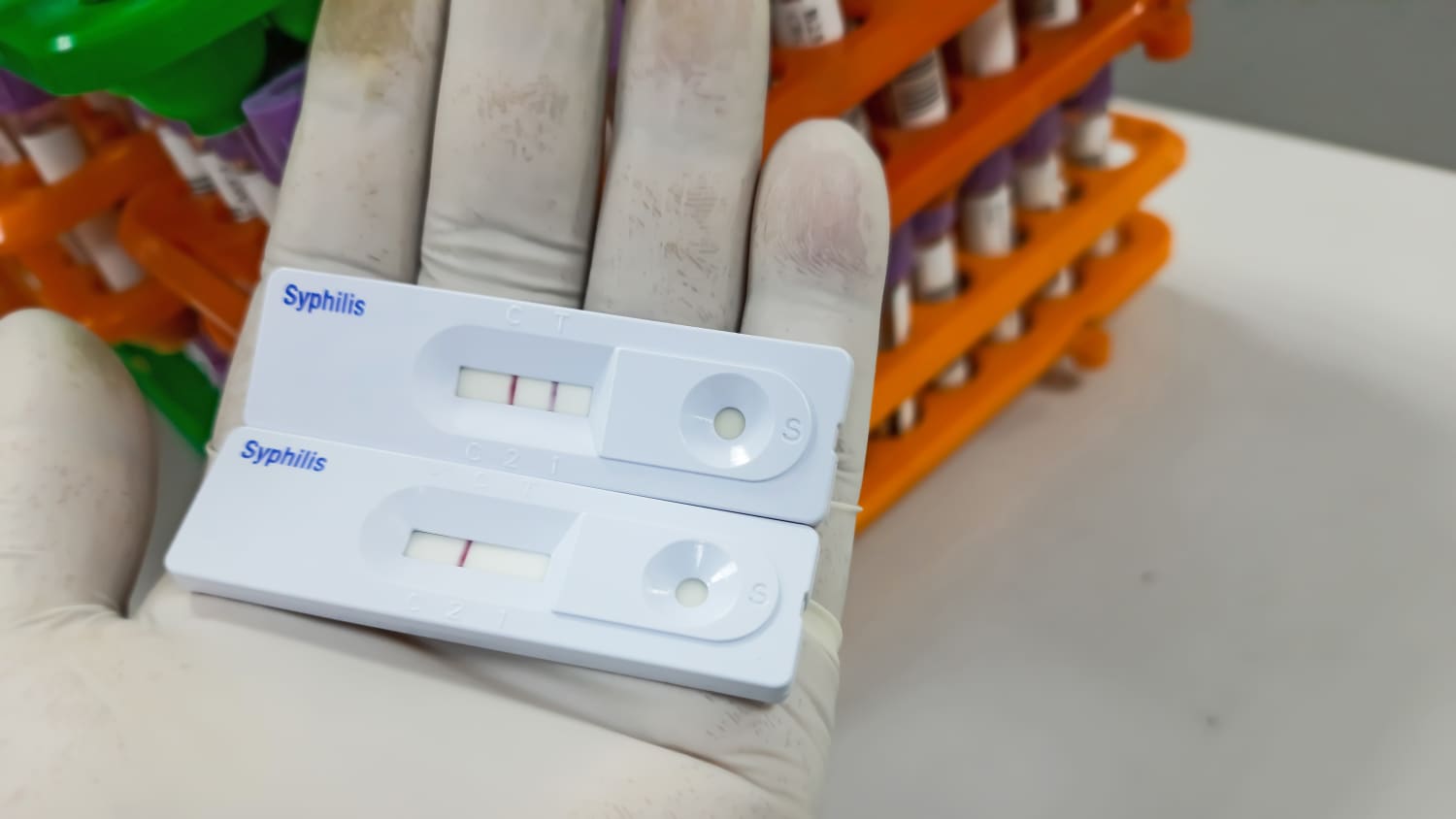 Eine mit Gummihandschuhen bekleidete Hand hält zwei Syphilis Schnelltests