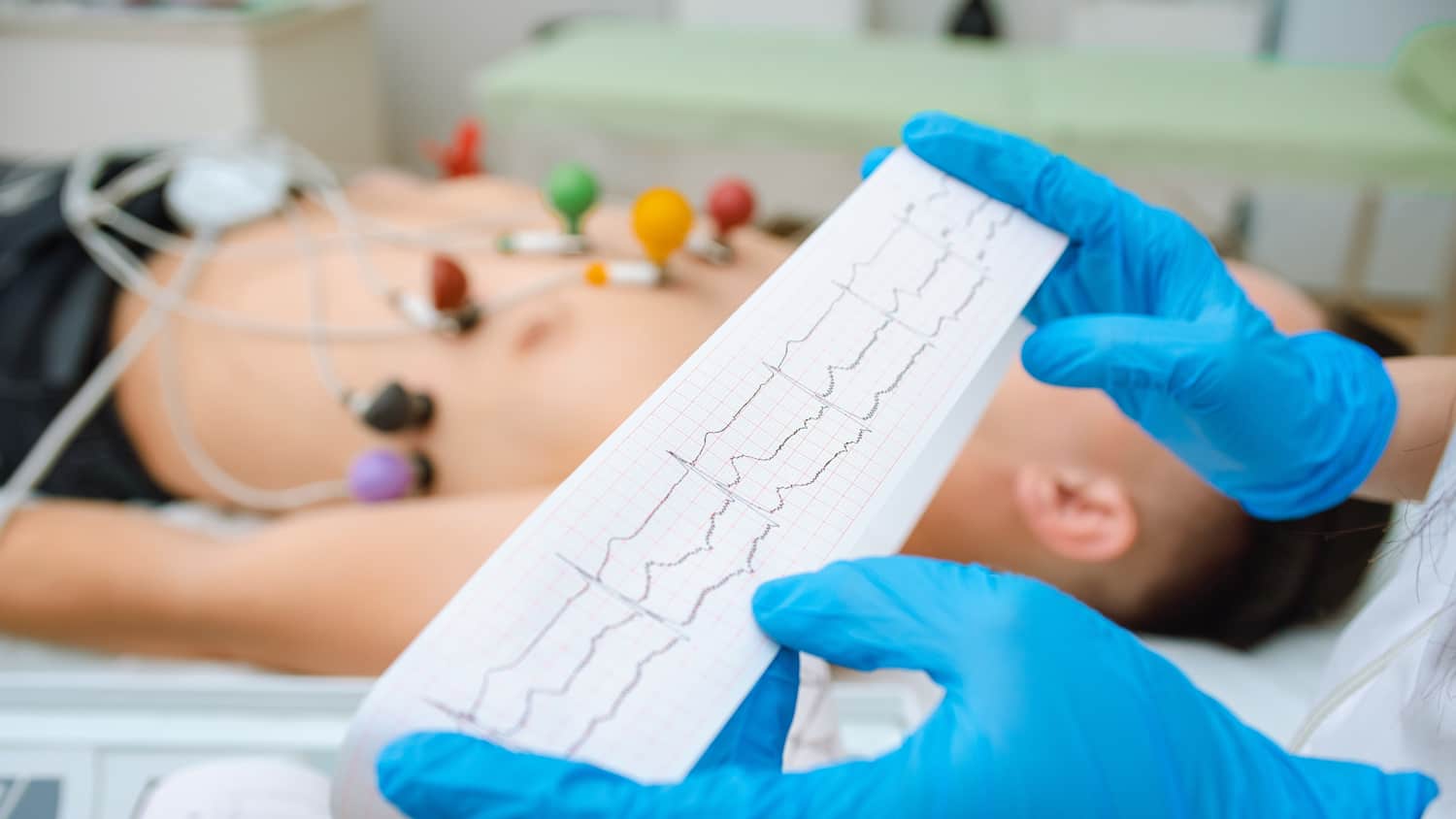 Ein Arzt wertet ein EKG aus während der Patient auf der Untersuchungsliege liegt