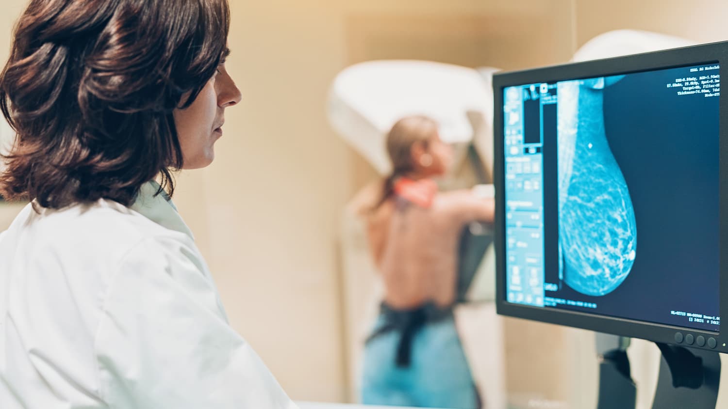 Arzt und Patient machen eine Mammographie