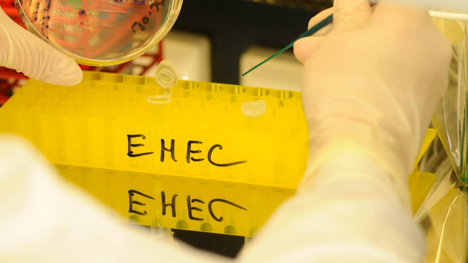 Labar untersuchung EHEC Virus