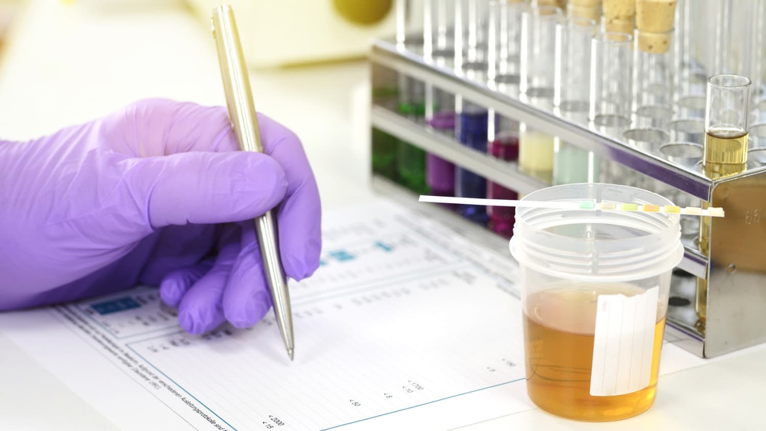 Chemielabor, Reagenzgläser