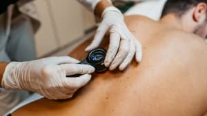 Eine Dermatologin untersucht Muttermale auf der Haut des Patienten mit einem Dermatoskop.