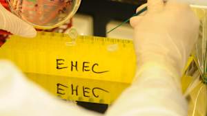 Labar untersuchung EHEC Virus