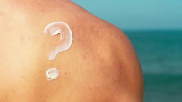Ein aus Sonnencreme geschmiertes Fragenzeichen ist auf der Schulter eines Mannes