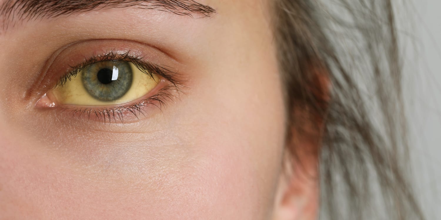 Hepatitis E Übertragung, Symptome und Behandlung